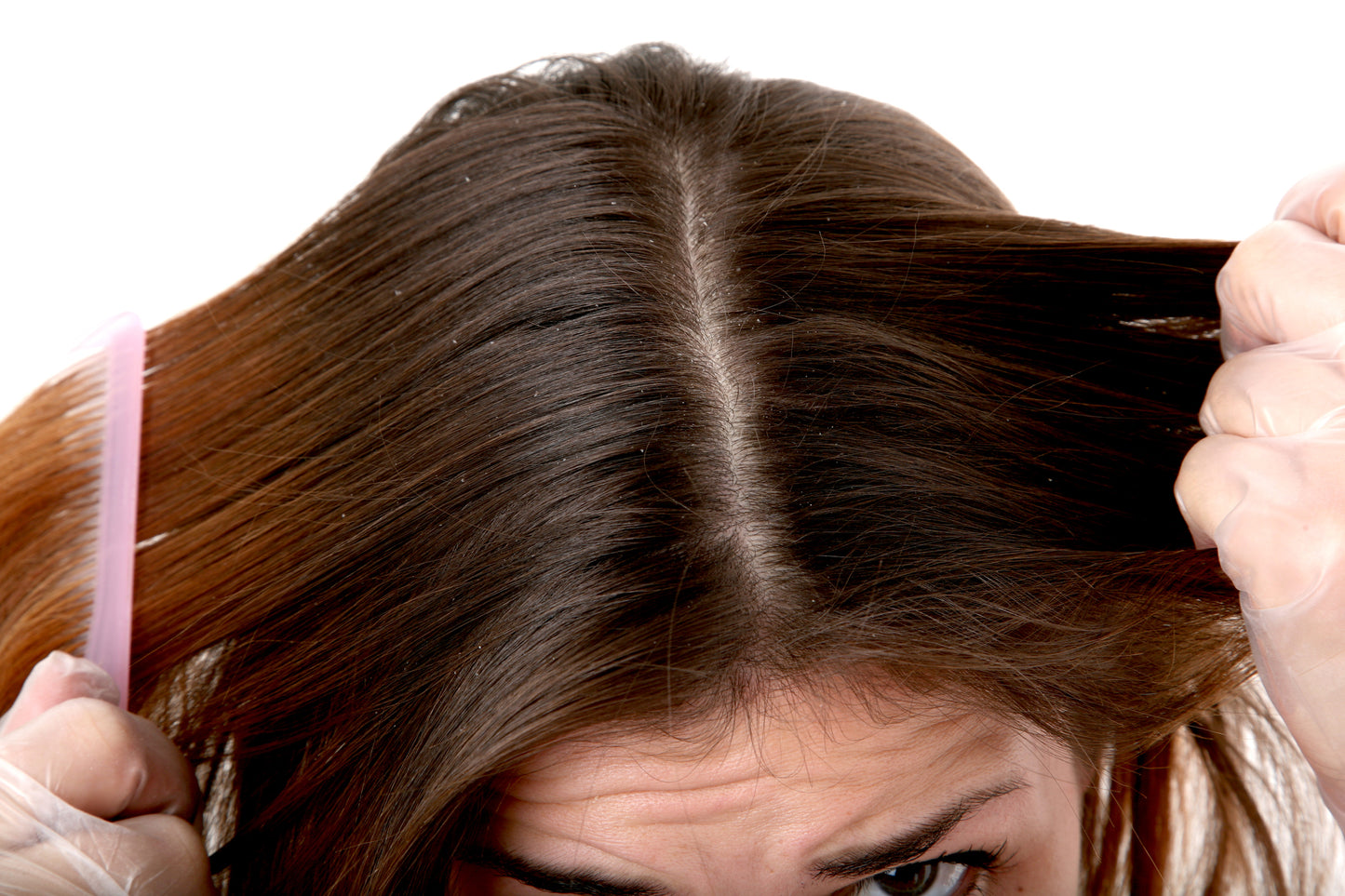 6 Stress Factors That May Be Causing Your Hair Loss or Thinning Hair